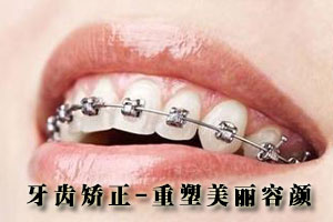 牙齿矫正需要进行拔牙吗?