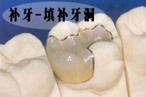 补牙会疼的原因有哪些？