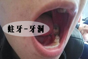 牙痛的治疗方法有哪些？
