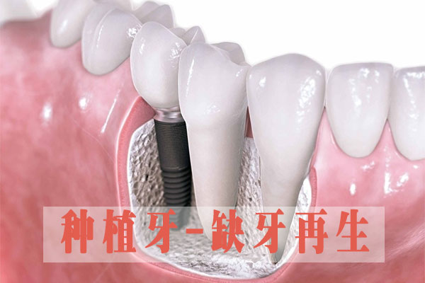 做烤瓷牙为什么需要磨牙？