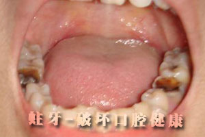 牙龈肿痛怎么办？