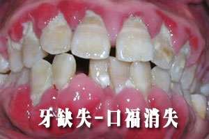 牙龈出血？小心牙周炎