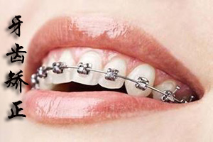 合肥做隐形美牙齿矫正需要多少钱?