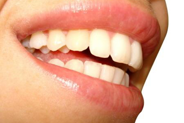 合肥儿童牙齿涂氟好处多多？