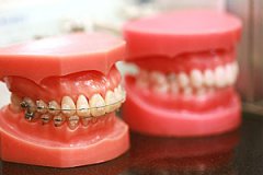 牙齿稀疏有哪些不好的影响？