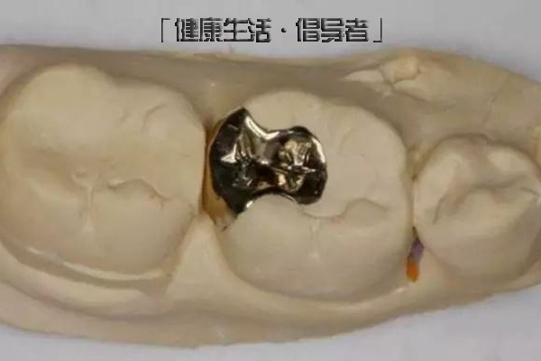 合肥补牙多少钱?