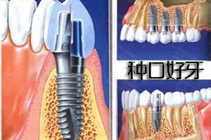 佳德口腔“好而不贵”优惠活动
