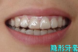 牙齿矫正如何进行判断？？