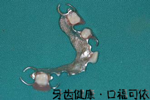 镶牙哪家好?
