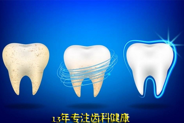 合肥全口牙种植需要多少钱?