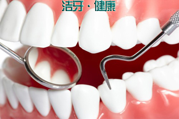 合肥洗牙多久洗一次比较好呢