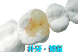 牙齿裂开