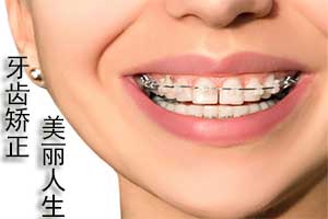 合肥牙齿矫正多少?