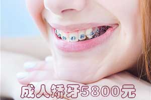 合肥牙齿矫正,牙齿矫正牙科
