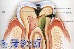 牙周炎会导致牙齿松动吗？