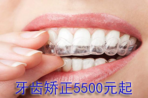 隐形美颜正畸的优势有哪些？