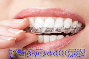 佳德口腔升级回馈—成人矫正低至5800元，高可减免8000元