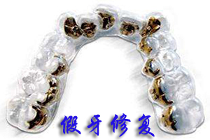 合肥舌侧隐形矫正多少钱