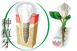 合肥种植牙修复一般过程