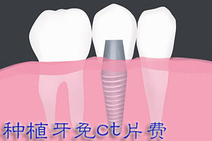 合肥哪家齿科种植牙好？