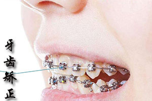 乳牙畸形有必要矫正吗？