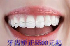 合肥哪家做牙齿矫正好?