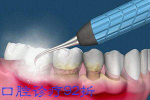 合肥洗牙哪里好？