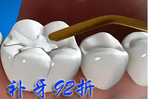 合肥补牙需要多少钱？