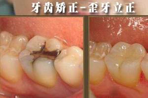 合肥补牙哪个医院好？