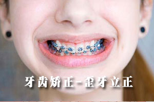 合肥戴牙套矫正牙齿多少钱