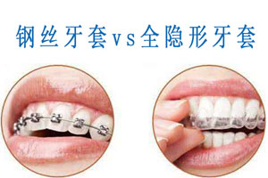 成人选择哪种牙齿矫正方式好？