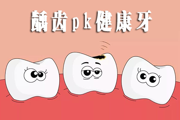 蛀了牙补牙多少钱一颗？