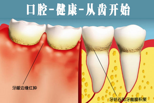 牙齿疾病怎么治疗？