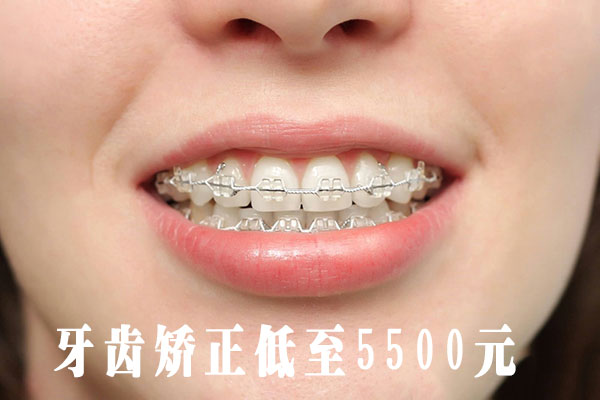 合肥的口腔牙科正畸