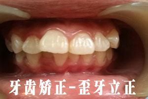 合肥的口腔牙科矫正牙齿？