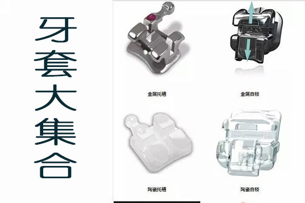 合肥牙科牙齿矫正多少钱