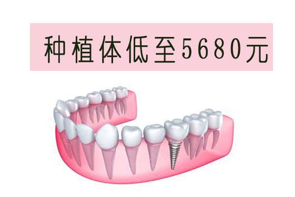 佳德口腔种植牙全民公开课