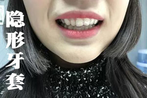 合肥佳德口腔正畸技术推广月