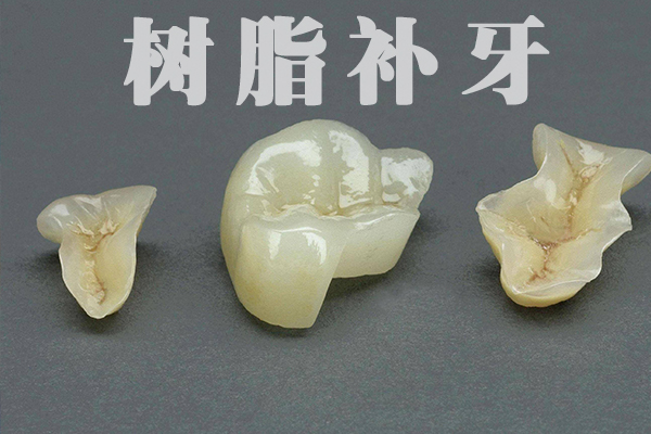 合肥补牙要多少钱？