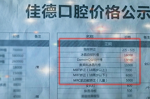合肥佳德口腔整牙价格