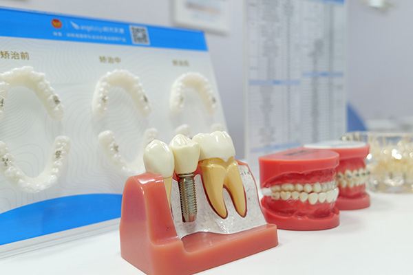 合肥牙齿复杂拥挤矫正多少钱？