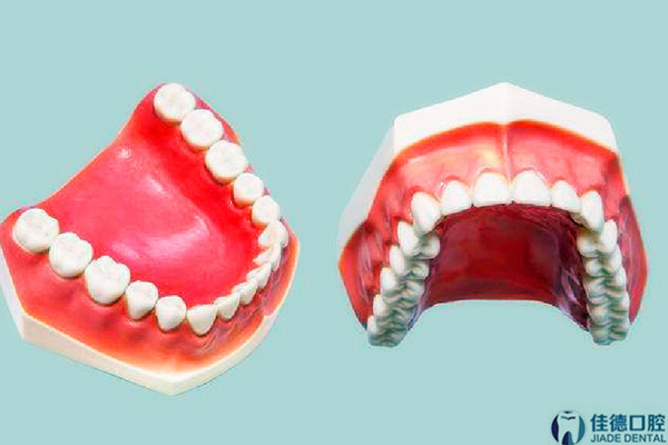 合肥戴牙套矫正牙齿多少钱？