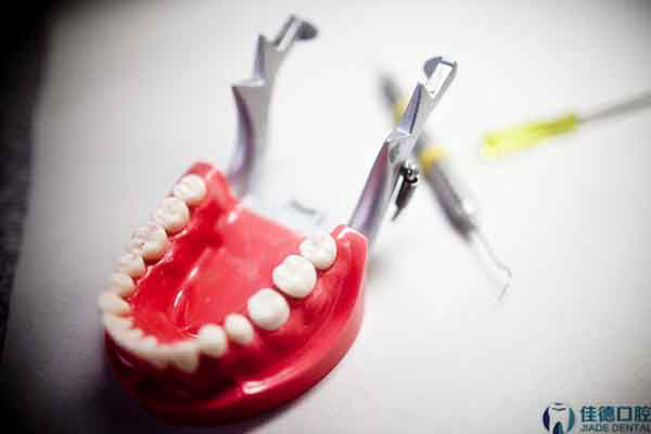 合肥箍牙齿矫正多少钱？