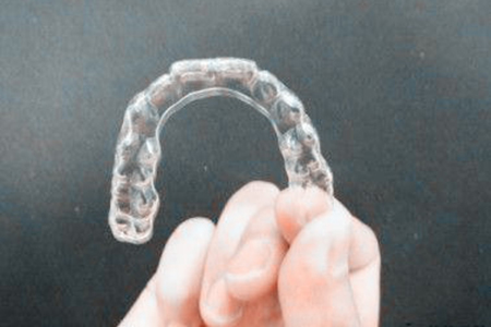 合肥牙齿隐形矫正价格