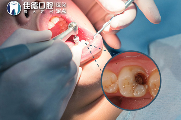 合肥牙科收费价目表？
