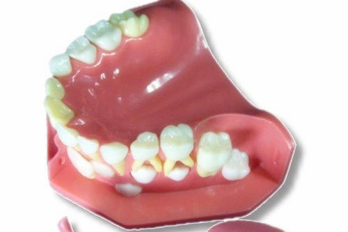合肥儿童牙齿畸形