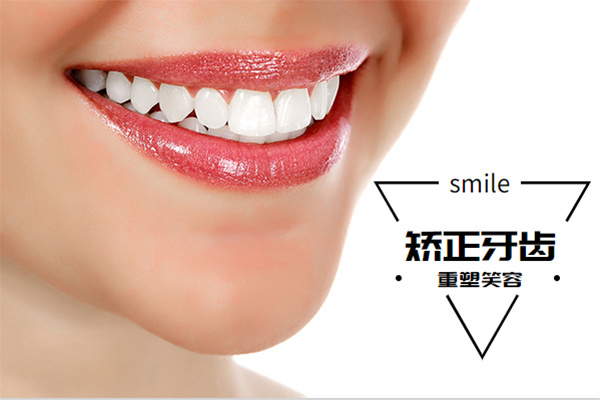 合肥牙齿正畸哪家好