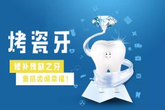 烤瓷牙哪种比较好？