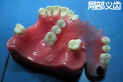 活动义齿种类和材料有哪些？