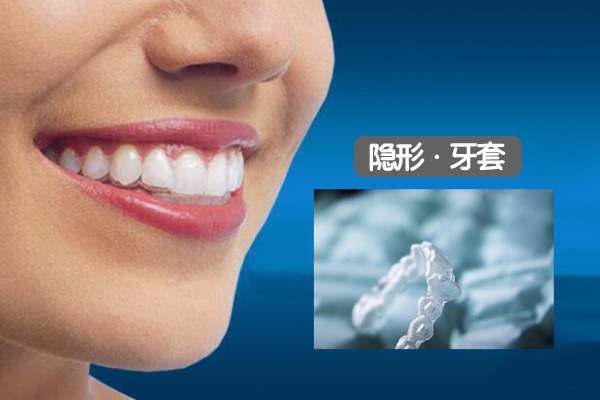 隐形矫正